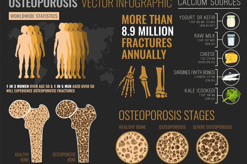 Is Osteoporosis Normal With Aging? Find Out Here Morada Senior Living