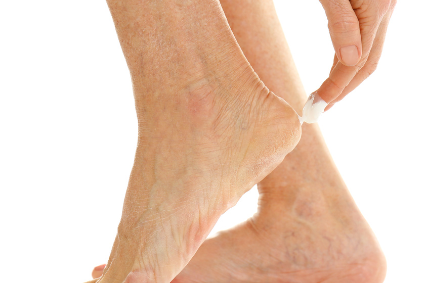 Foot Care Management In Senior Assisted Living In Euless, TX Morada