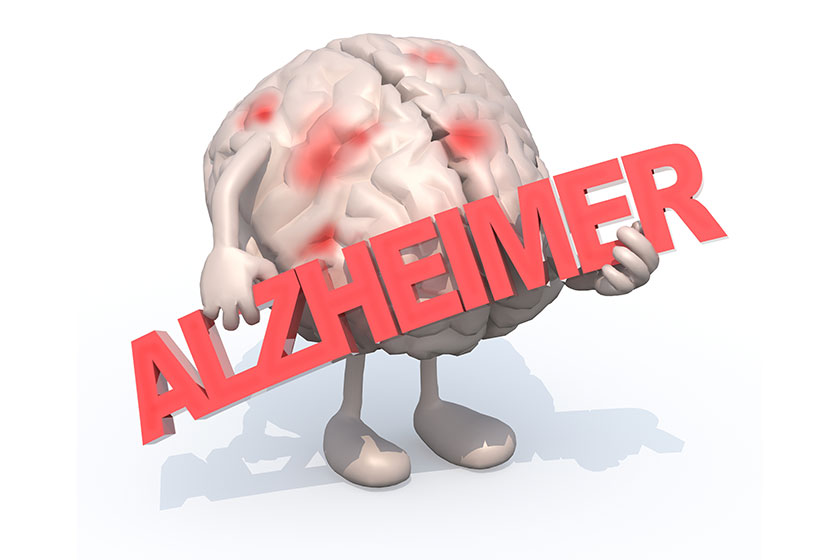 Memory Tests for Dementia to Help Diagnose and Manage Cognitive Decline